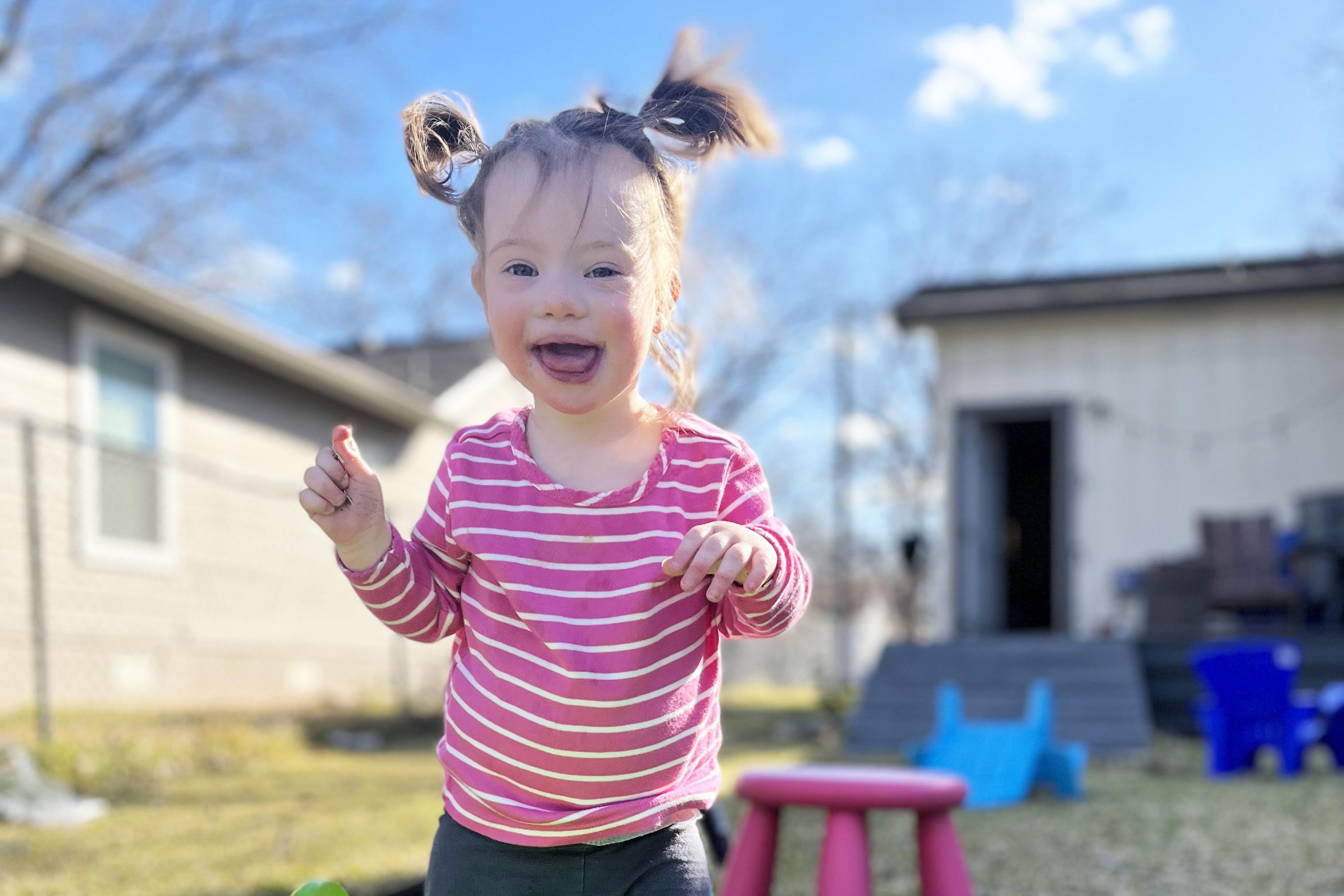 Down syndrome Awareness